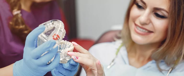 Implantes dentales: Los beneficios que ofrece para tu salud oral