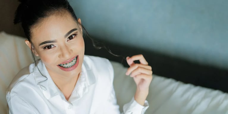 Brackets: Mejora tu salud dental y disfruta de una linda sonrisa