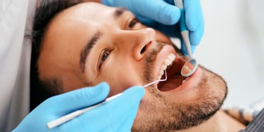 Endodoncia: 5 beneficios para mejorar tu salud bucal