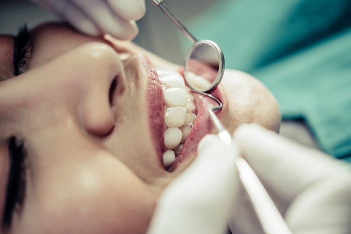 5 Beneficios de la Limpieza Dental