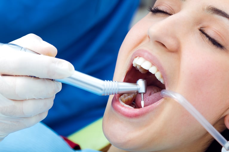 Diferencia entre limpieza y blanqueamiento dental