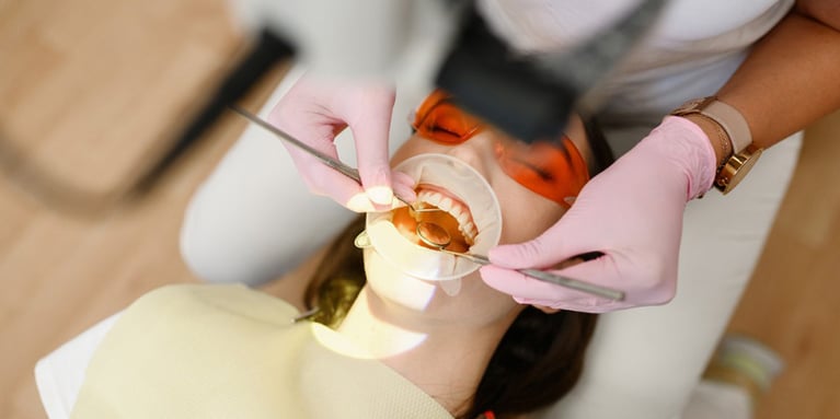Rehabilitación oral y su importancia en tu salud bucal
