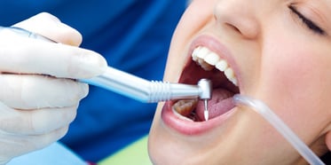 Profilaxis dental: Riesgos por no realizarla